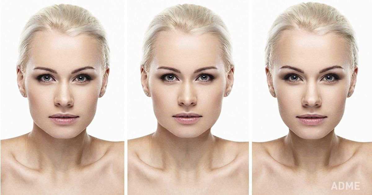 Асимметрия лица: причины и лечение у взрослых, фото | исправить несимметричное лицо без операций в клинике орто-артель