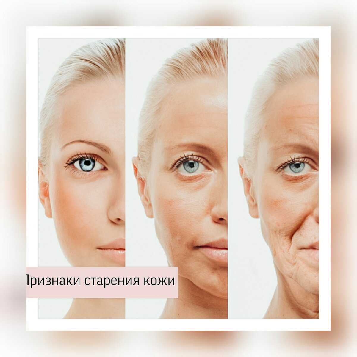 Факторы возрастных изменений. Старение кожи лица. Возрастные изменения кожи тела. Признаки старения. Возрастные изменения лица у женщин.
